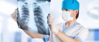 How effective is fluorography for pneumonia?