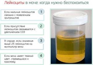 Unchanged red blood cells in the urine. What does this mean, increased, reasons, norm 