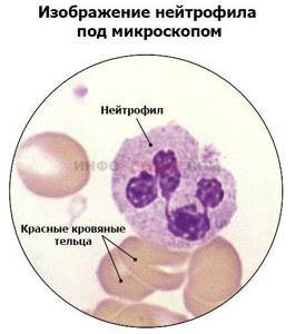 Immature granulocytes are increased: what does this mean, reasons for the increase and the norm