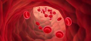Low hemoglobin in oncology