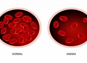 Normal hemoglobin level in men