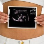 Is it necessary to do an ultrasound in the first trimester of pregnancy?