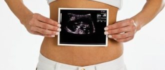 Нужно ли делать УЗИ в первом триместре беременности