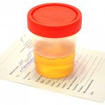 General urine analysis