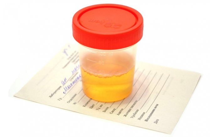 General urine analysis