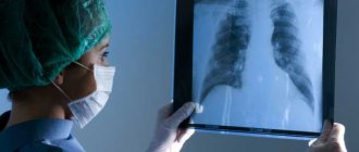 Описание профессии врача-рентгенолога - где учиться, зарплата, плюсы и минусы