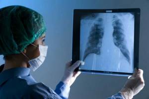 Описание профессии врача-рентгенолога - где учиться, зарплата, плюсы и минусы