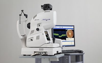 Optical coherence tomography