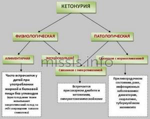 Main types of ketonuria