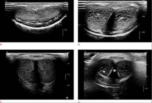 features of male ultrasound