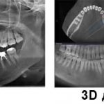 The difference between 3D diagnostics and x-rays