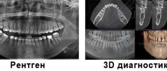Отличие 3D диагностики от рентгена