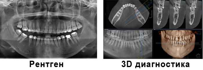 Отличие 3D диагностики от рентгена