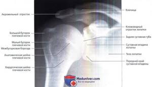 Pathologies of the shoulder joint: snapshot