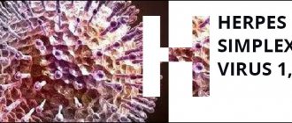 PCR diagnostics of herpes virus (HERPES SIMPLEX VIRUS 1,2)