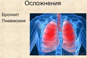 Pneumonia and bronchitis