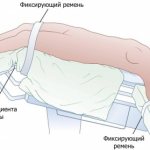 Trendelenburg position. What is it, how is it used for operations, x-rays, anaphylactic shock 