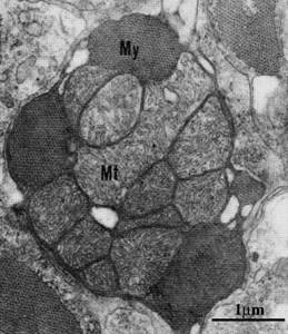 Cross section of myocytes of the ventricles of the heart