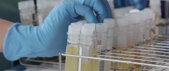 Urine culture for microflora is a method that allows you to determine the quantitative and qualitative composition of identified bacteria