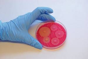 culture for gonorrhea pathogen with sensitivity to antibiotics