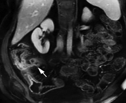 Post-contrast MR image of the abdominal organs