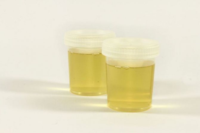 urine test according to Addis Kakovsky