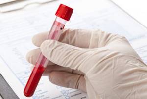 Test tube with blood in the hand of a laboratory assistant performing a clinical blood test