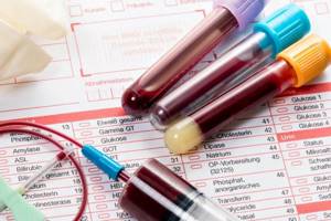 Test tubes with blood and a form for filling out test results