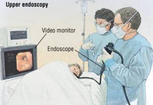 процесс-проведения-эндоскопии.jpg