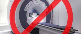 MRI contraindications