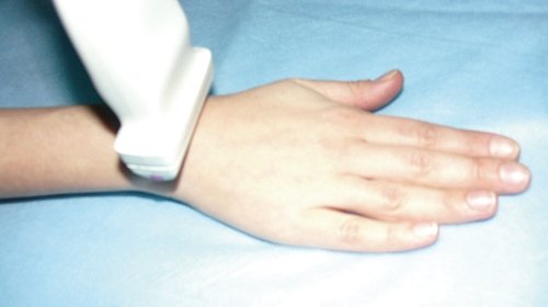 Ultrasound probe placement when examining the dorsum of the wrist and extensor tendons
