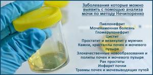 Interpretation and norm of urine analysis according to Nechiporenko in a child - how to take it