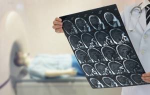 interpretation of brain MRI results