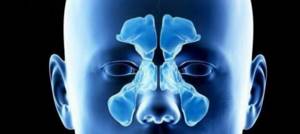 X-ray of the sinuses of a healthy person
