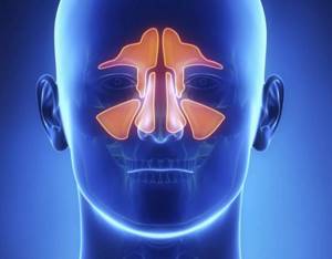 X-ray of the sinuses