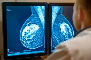 Mammography result on the screen