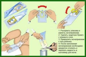 collecting a urine test from a baby