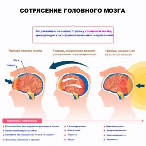 Symptoms of a concussion.jpg