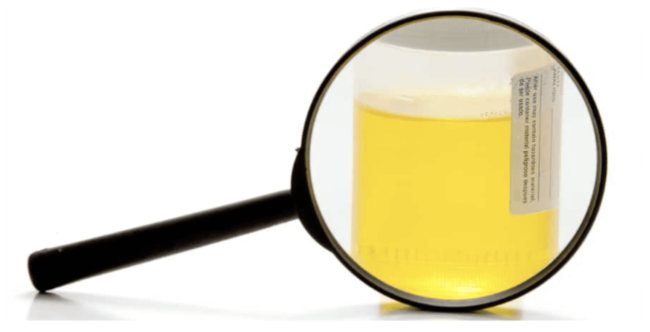 How long to store baby urine for analysis?