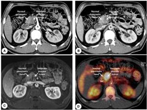 MRI images of the abdomen