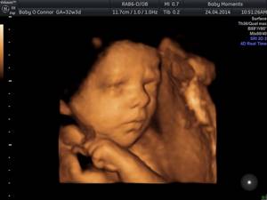 Photograph of the fetus while awake