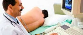 Transrectal ultrasound of the prostate