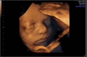3D image of a sleeping embryo