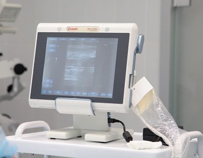 Ultrasound scanner of the latest generation, on which the doctor performs an ultrasound of the veins in Moscow