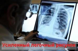 enhanced pulmonary pattern