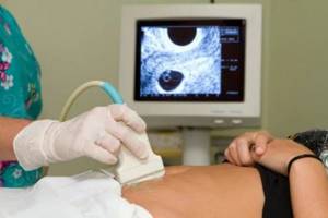 Ultrasound of the uterus