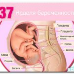 ultrasound at 37 weeks of pregnancy