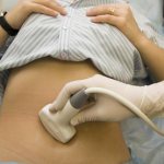 Ultrasound in early pregnancy at the multidisciplinary medical center M Clinic