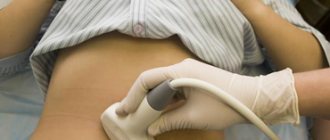 Ultrasound in early pregnancy at the multidisciplinary medical center M Clinic