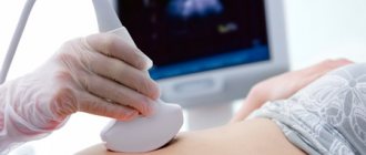 Ultrasound: how much and why?